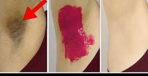 Foto: (Imagem sem texto alternativo disponivel ID [1867060])