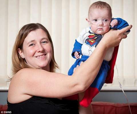 Bebê prematuro que tinha 50% de chance de sobreviver completa 2 anos