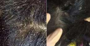 Foto: (Imagem sem texto alternativo disponivel ID [1148821])