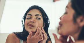 Como comer chocolate na Páscoa sem prejudicar sua pele, segundo dermatologista