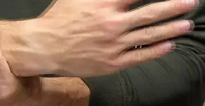 Os sintomas incomuns do Parkinson