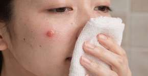 Foto: (Imagem sem texto alternativo disponivel ID [2686944])