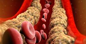 Foto: (Naeblys/istock)