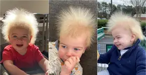 Conheça a síndrome rara que faz cabelo de menino estar sempre arrepiado
