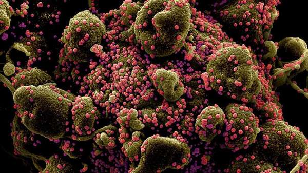 Vírus Sars-COV-2 (em rosa) infectam células humanas, que replicam material genético e morrem