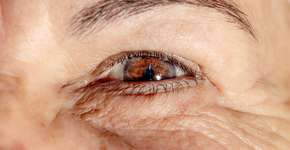 Foto: (Marcelo_minka/istock)