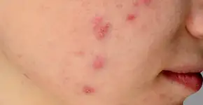 16 coisas que os dermatologistas querem que você entenda