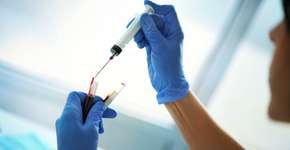 Foto: (gilaxia/istock)