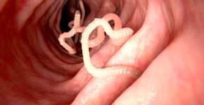 Foto: (selvanegra/istock)