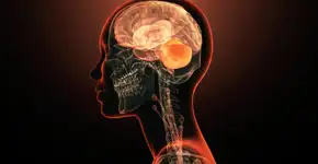 Pacientes com Alzheimer passam a ter novo tratamento no SUS