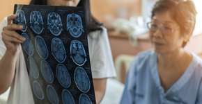 Sim, seu estilo de vida definirá como o seu cérebro envelhecerá