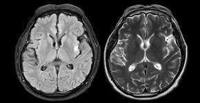 Foto: (mr.suphachai praserdumrongchai/istock)