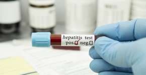 Foto: (blueshot/istock)