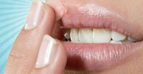 Foto: (Imagem sem texto alternativo disponivel ID [792675])