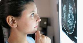 8 fatores que colocam você em risco para o câncer de mama