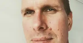 Foto: (divulgação/gofundme)