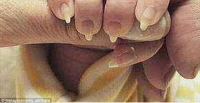 Imagem de bebê com unhas grandes deixa internet horrorizada