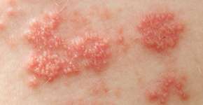 Foto: (clsgraphics/istock)