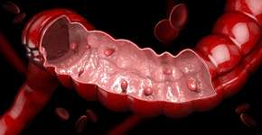 Foto: (tussik13/istock)