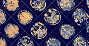 Foto: (iStock/sudok1)