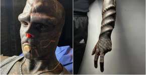 ‘Alien humano’ simula uma ‘boca extra’ na face