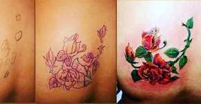 Tatuagens ajudam mulheres a esconder marcas da violência