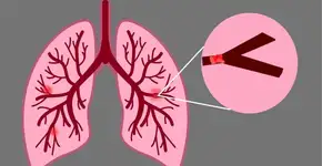 Foto: (Imagem sem texto alternativo disponivel ID [2753971])