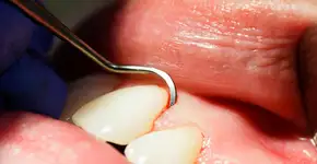 Foto: (RichLegg/istock)