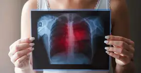 Foto: (Nikolay Amoseev/istock)