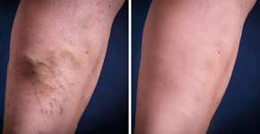 Foto: (Imagem sem texto alternativo disponivel ID [1621438])