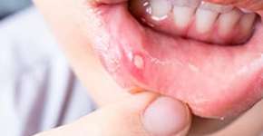 Foto: (Imagem sem texto alternativo disponivel ID [1866815])