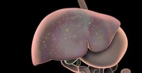 Foto: (Ozgu Arslan/istock)