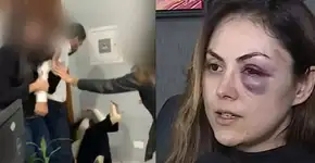 Agressor de procuradora é solto por não ter sido pego em ‘flagrante’