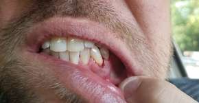 Foto: (:Justin Smith/istock)