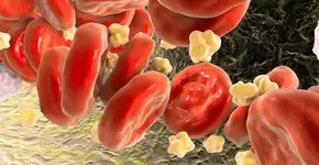 Harvard revela 5 atitudes eficazes para baixar o colesterol ruim