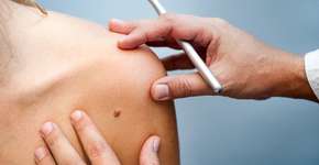 Atendimentos dermatológicos gratuitos na Virada da Pele Saudável