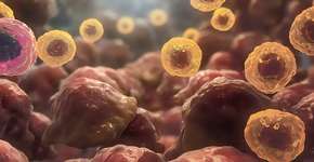 Foto: (Ozgu Arslan/istock)