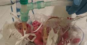 Foto: (Imagem sem texto alternativo disponivel ID [1834634])