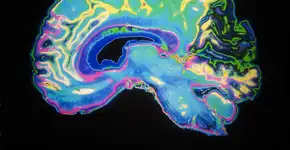 Pesquisa revela fator que pode atrasar início de Alzheimer em 5 anos