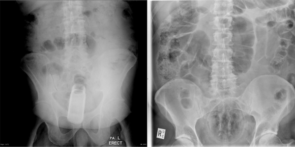 Divulgação: Radiopedia 