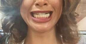 Foto: (Imagem sem texto alternativo disponivel ID [1191690])