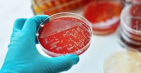 Foto: (jarun011/istock)