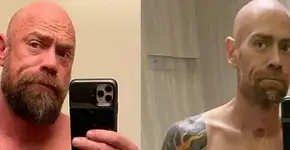 Antes e depois: enfermeiro choca o mundo ao mostrar efeitos da covid-19