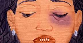 Foto: (Imagem sem texto alternativo disponivel ID [1834550])