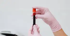 Exame de sangue detecta câncer antes mesmo dos sintomas