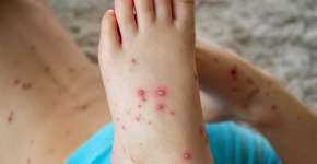 Foto: (Povorozniuk Liudmyla/istock)