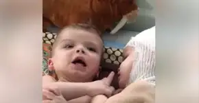 Gêmeos siameses fazem carinho um no outro após cirurgia