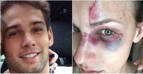 Jovem agredida por brasileiro nos EUA grava briga com namorado