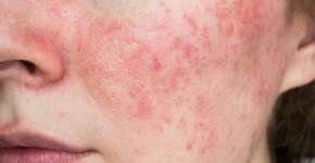 Foto: (iSTock/Yuliya Shauerman)