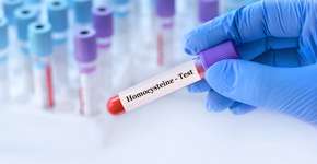 Foto: (SyhinStas/istock)